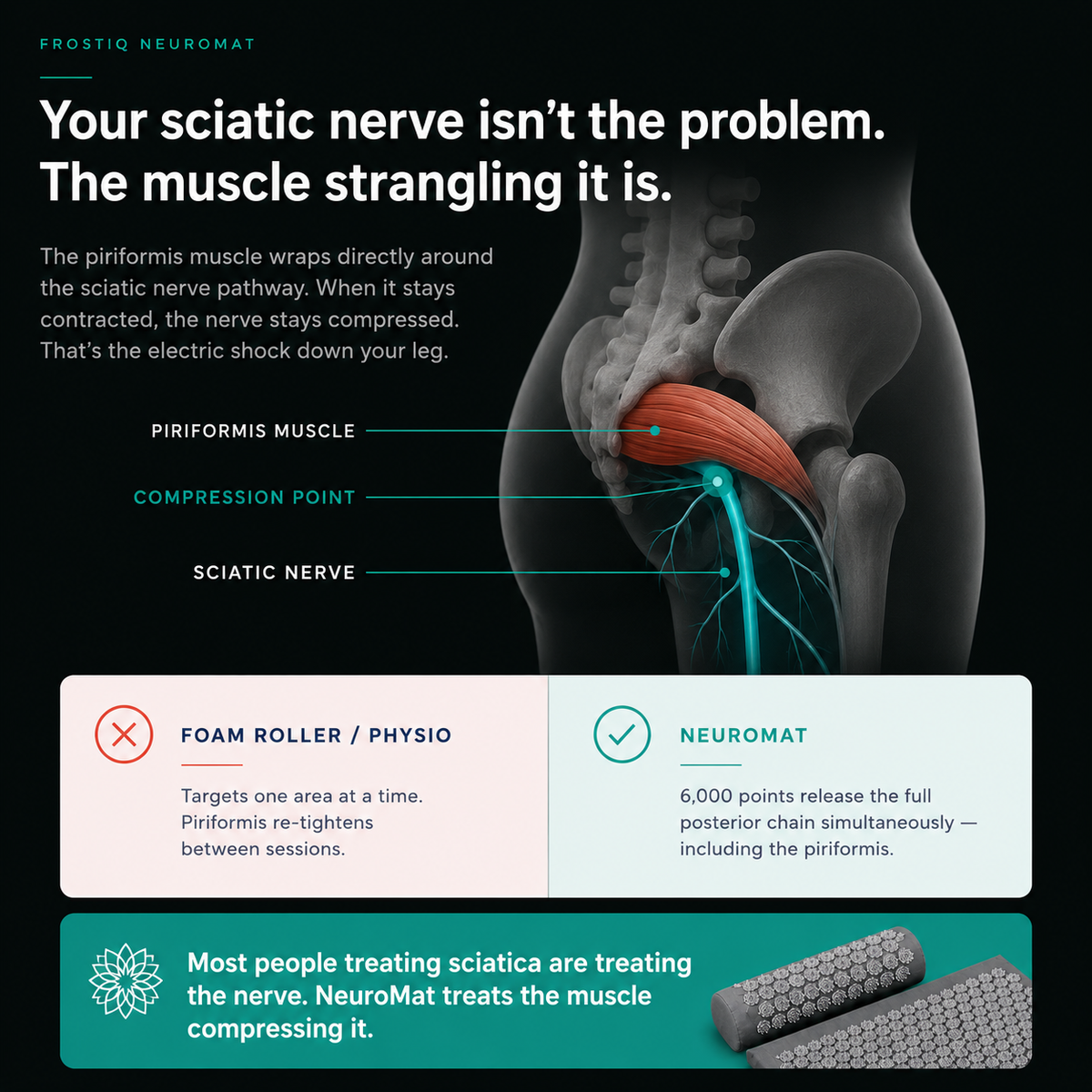 FROSTIQ NeuroMat